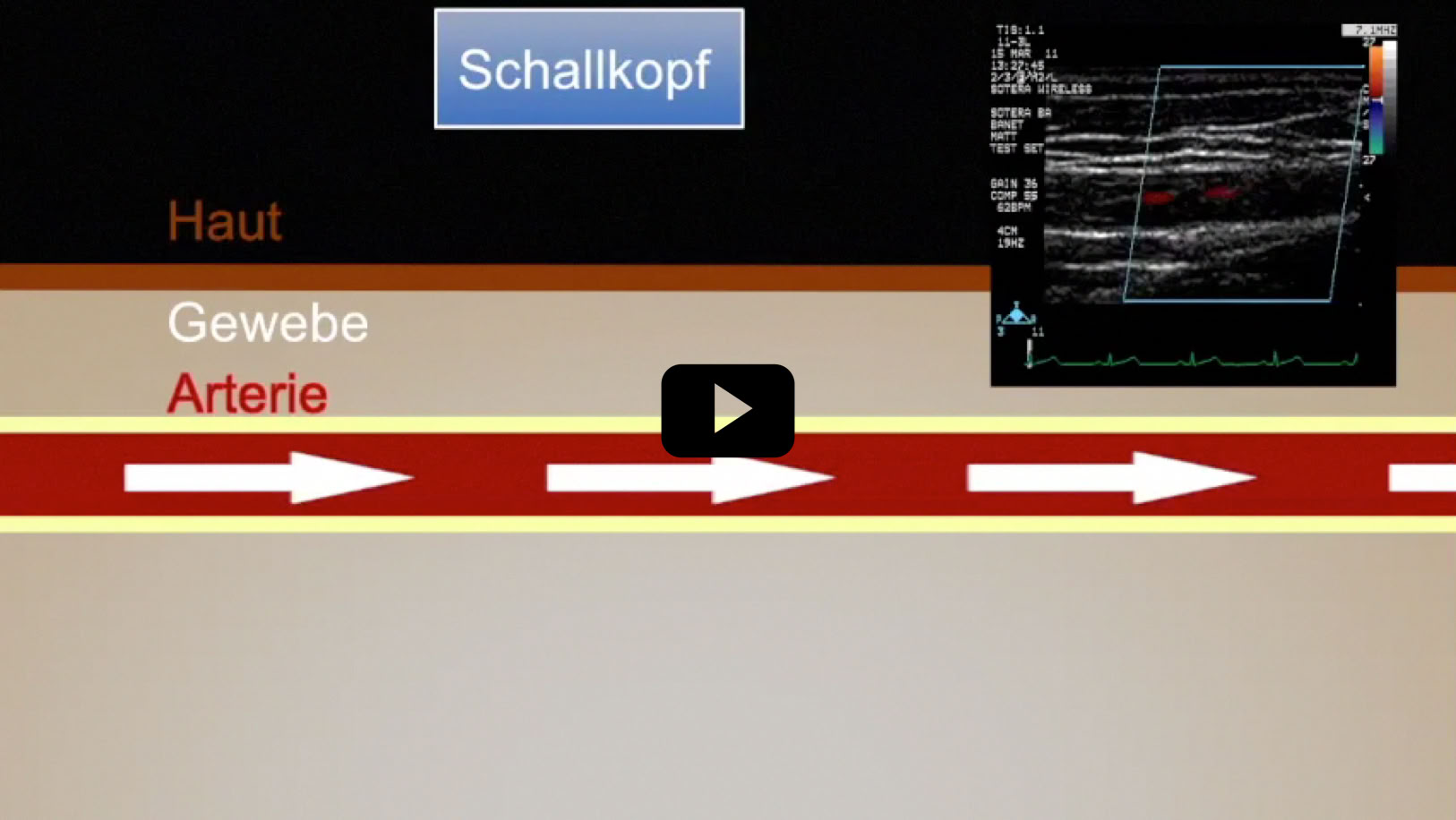 Video Video abspielen